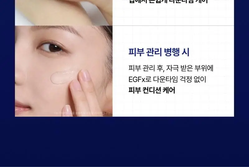 [트러블SOS진정]이지듀 EGFx 다운타임 오인트 겔 15ml 기획(+크림 7ml) 상세페이지 29